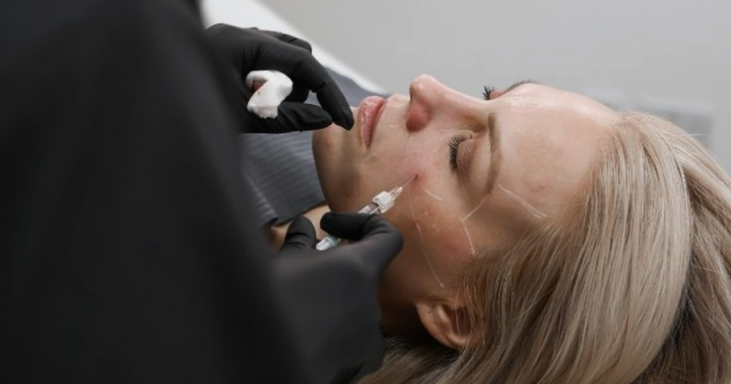 Filler dissolving for new injectors on patient.