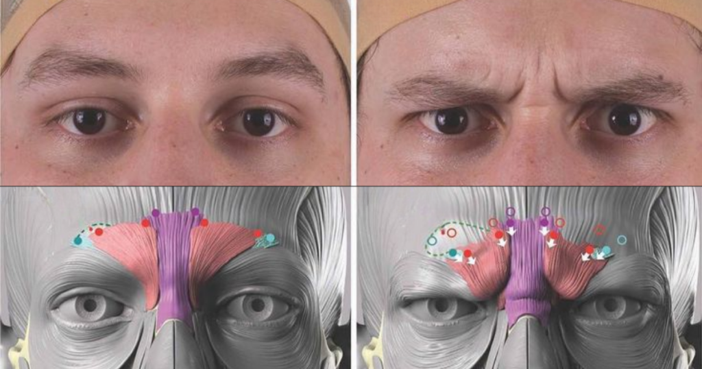 Demonstrating facial movement in aesthetic injectables during dynamic assessment.